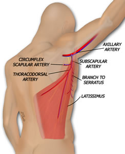 MLD Phalloplasty